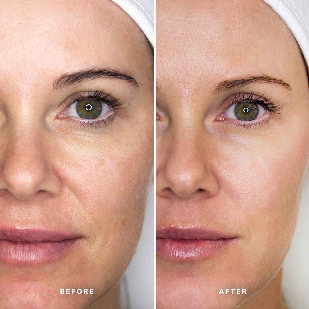 Beauty Sleep Power Peel