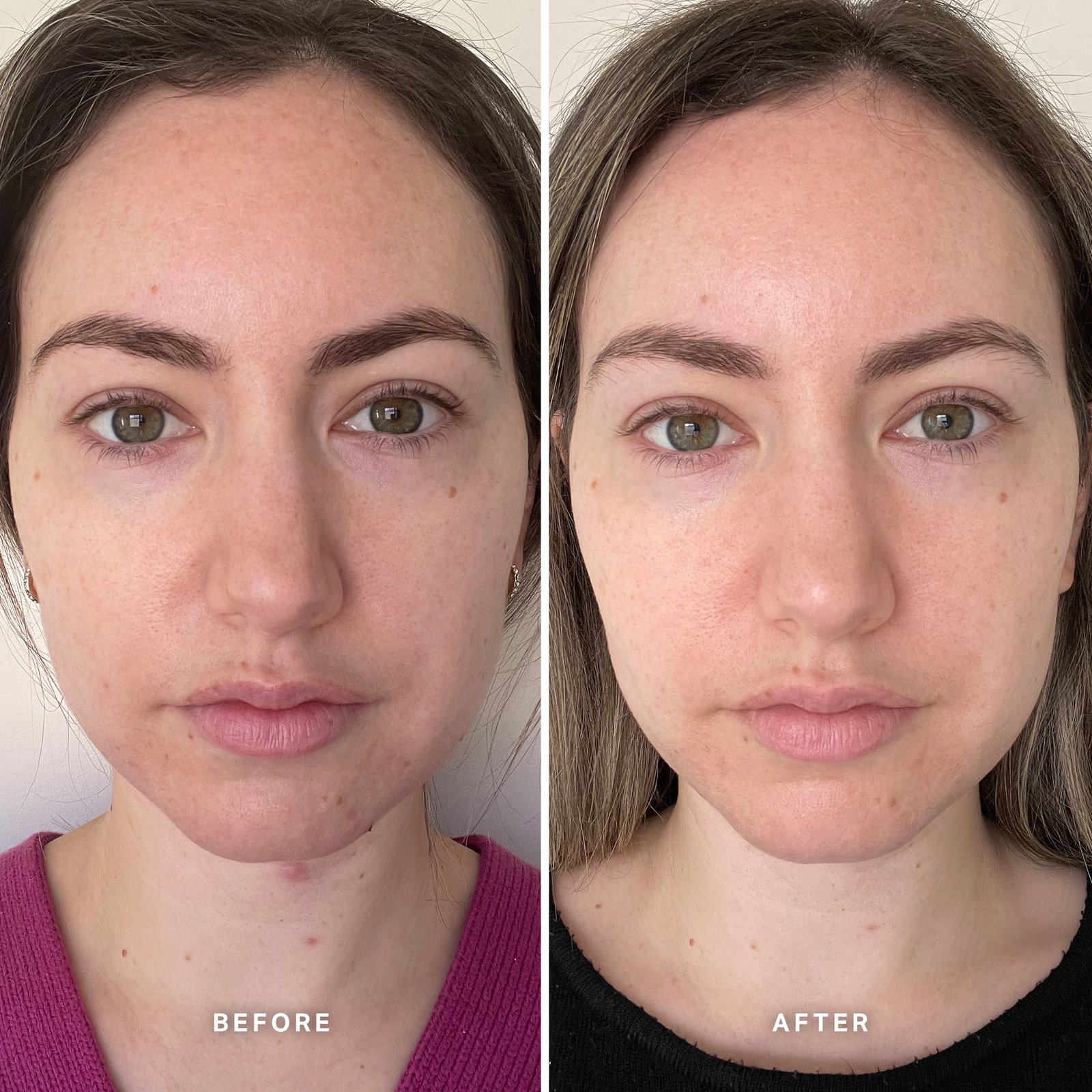 Vitamin B Serum