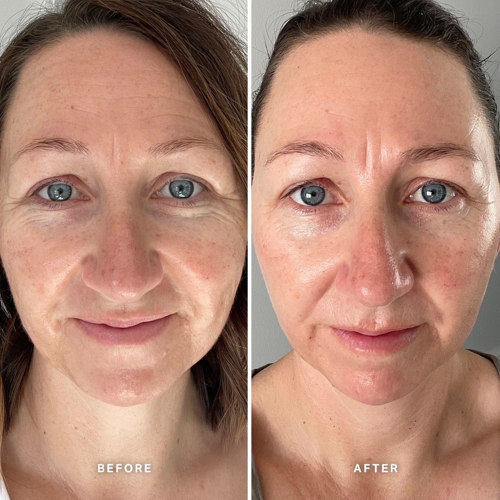 Vitamin E serum